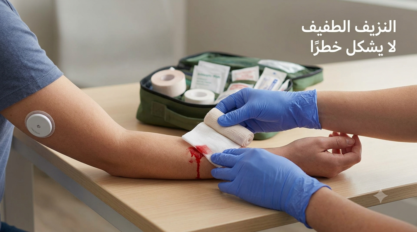 النزيف تحت المستشعر: متى تزيله؟